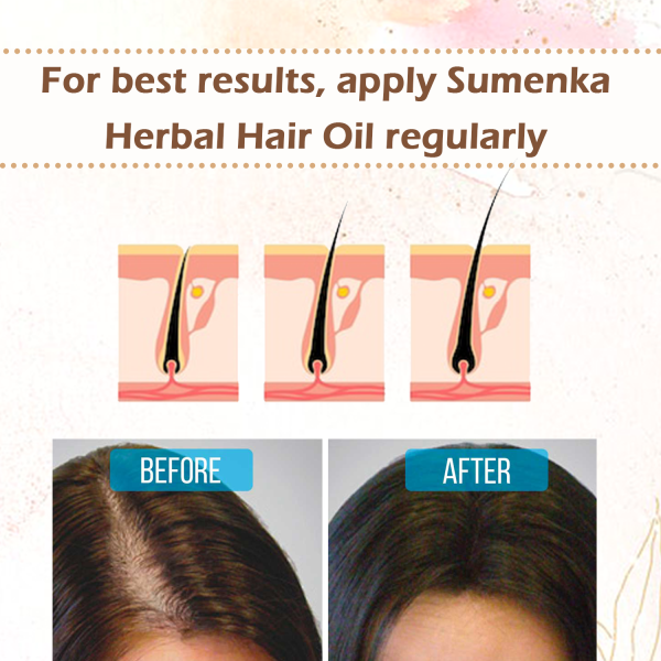 Sumenka Hair oil herbal, oil for hair loss and regrowth
